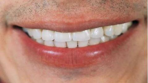 Los dientes | Recurso educativo 46593