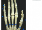 Quiz: Hand bones | Recurso educativo 60077