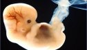 Embriología humana | Recurso educativo 60238