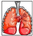 Enfermedades pulmonares de origen ocupacional | Recurso educativo 76237