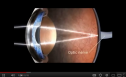 Video: Human eye | Recurso educativo 77390