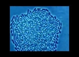 Crecemento bacteriano baixo un microscopio óptico | Recurso educativo 787605